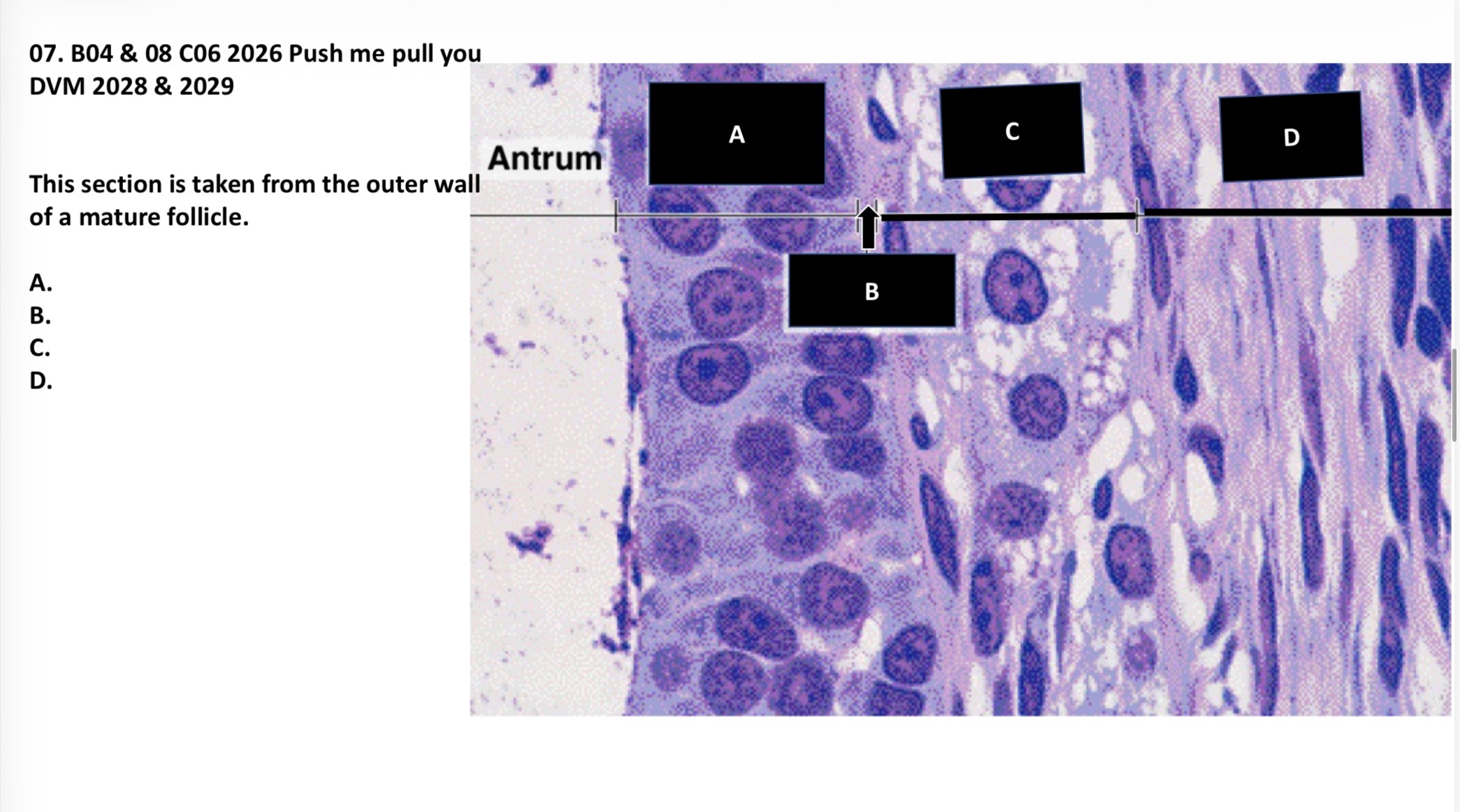 <p>This section is taken from the outer wall of a mature follicle. Label A-D.</p>