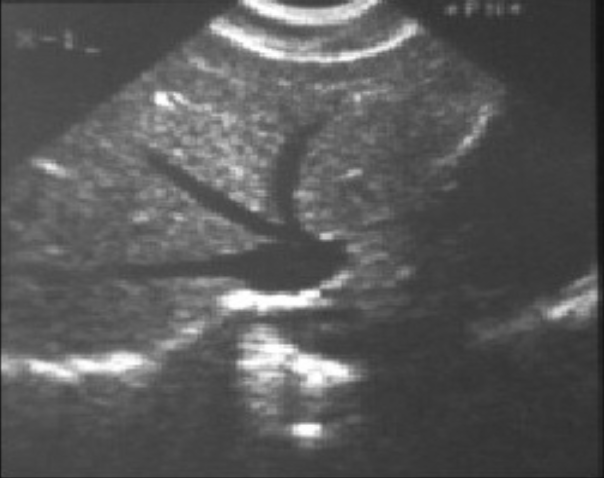 <p>what is the image showing?</p>