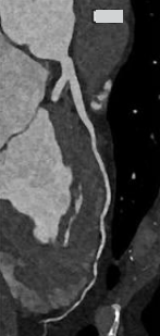 <p>Name the vessel </p>