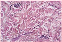 <p>Purple dots are the nuclei of fibroblasts</p>