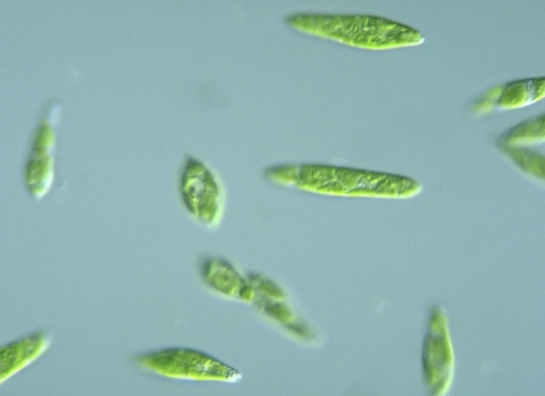<p>What is this protist? (genus name) </p>