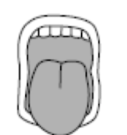 <p>what mallampati is this </p>