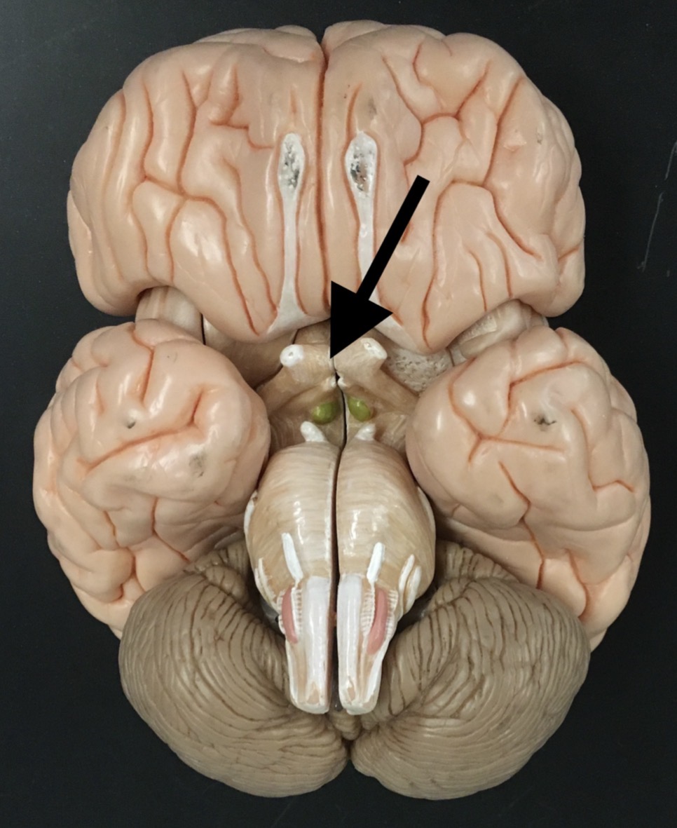 <p>What is the arrow pointing to?</p>