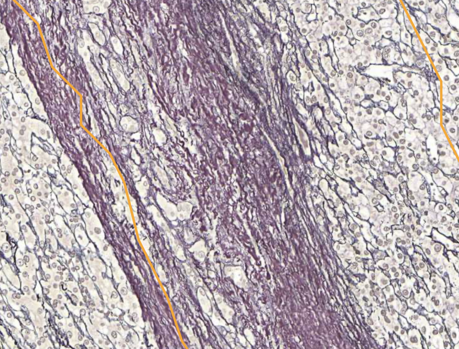 <img src="https://assets.knowt.com/user-attachments/04e746fc-5000-428c-aad4-851831c25ec7.png" data-width="100%" data-align="center" alt="knowt flashcard image"><p></p>