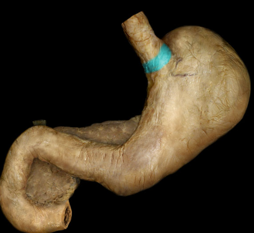 <p>area immediately surrounding the cardiac orifice</p>