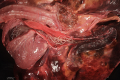<p>Here is the right side of the heart and pulmonary artery opened up. Name the parasite: </p><p>A) Onchocerca lupi </p><p>B) Spirocerca lupi </p><p>C) Dirofilaria immitis </p><p>D) Dirofilaria repens</p>