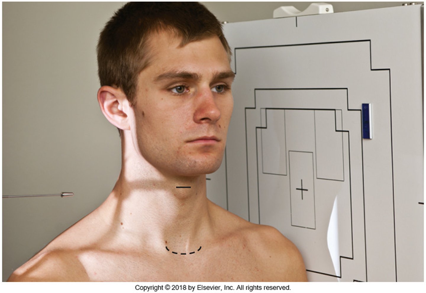 <p>- What is the exam?</p><p>- What is the position?</p><p>- What is demonstrated in this view?</p><p>- What is the SID?</p><p>- What is the patient's position?</p><p>- What do you ask the patient to do with their shoulders?</p><p>- What can you give or have the patient do if they can't relax their shoulders?</p><p>- The top of the IR should be about how many inches above what anatomy?</p><p>- Where is the CR directed?</p><p>- What are the breathing instructions?</p>