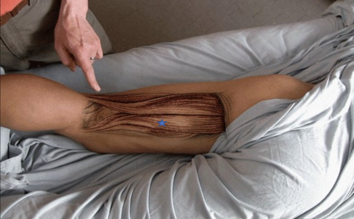 <p><span>From the list of muscles and actions below, identify the "starred" muscle and its primary actions.</span></p>