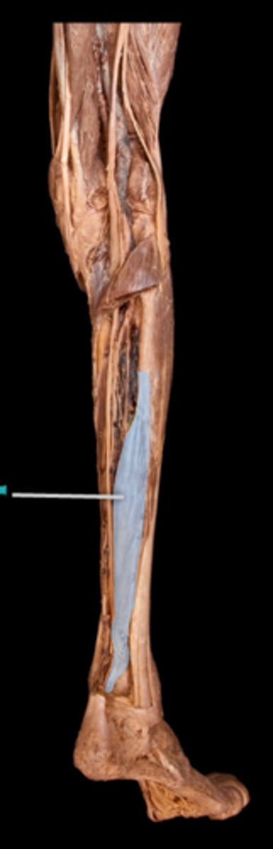 <p>What muscle is this?</p>