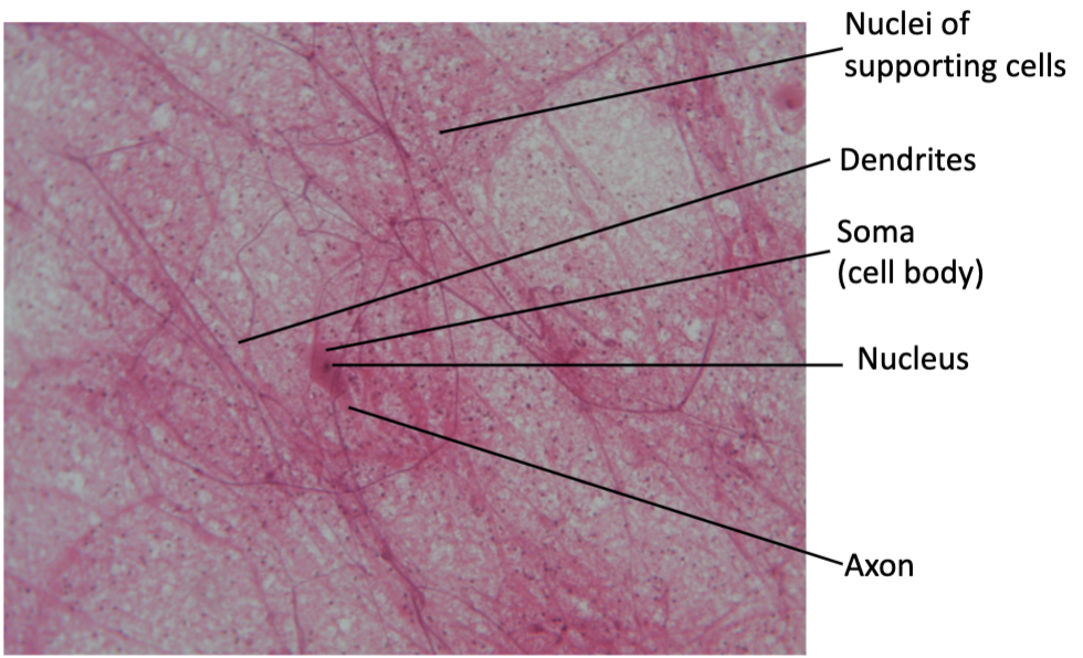 <p>What kind of tissue is this?</p>