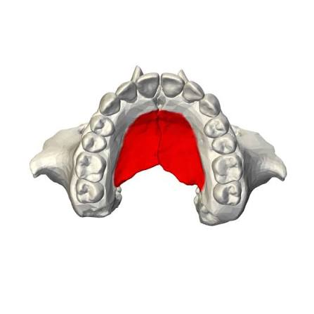 <p>Front part of hard (upper) palate</p><ul><li><p>Maxilla</p></li></ul><p></p>