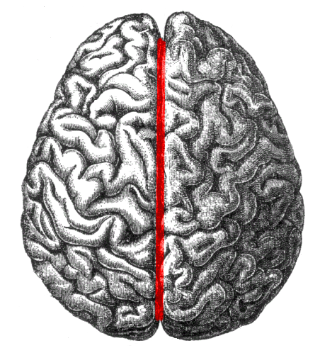 <p>Midline of the brain, separates the right and left </p>
