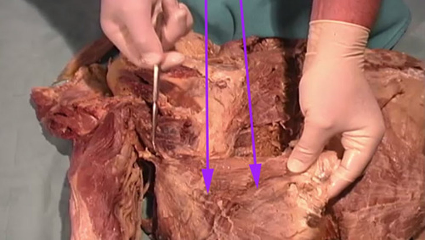 <p>What is the name of this muscle as indicated by the arrow?</p>