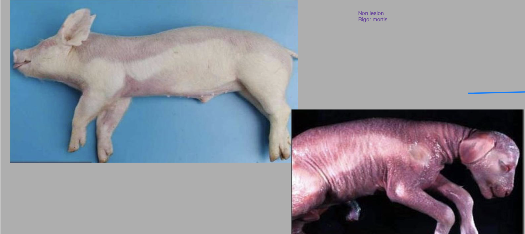 <p>non lesion or pathology?</p>