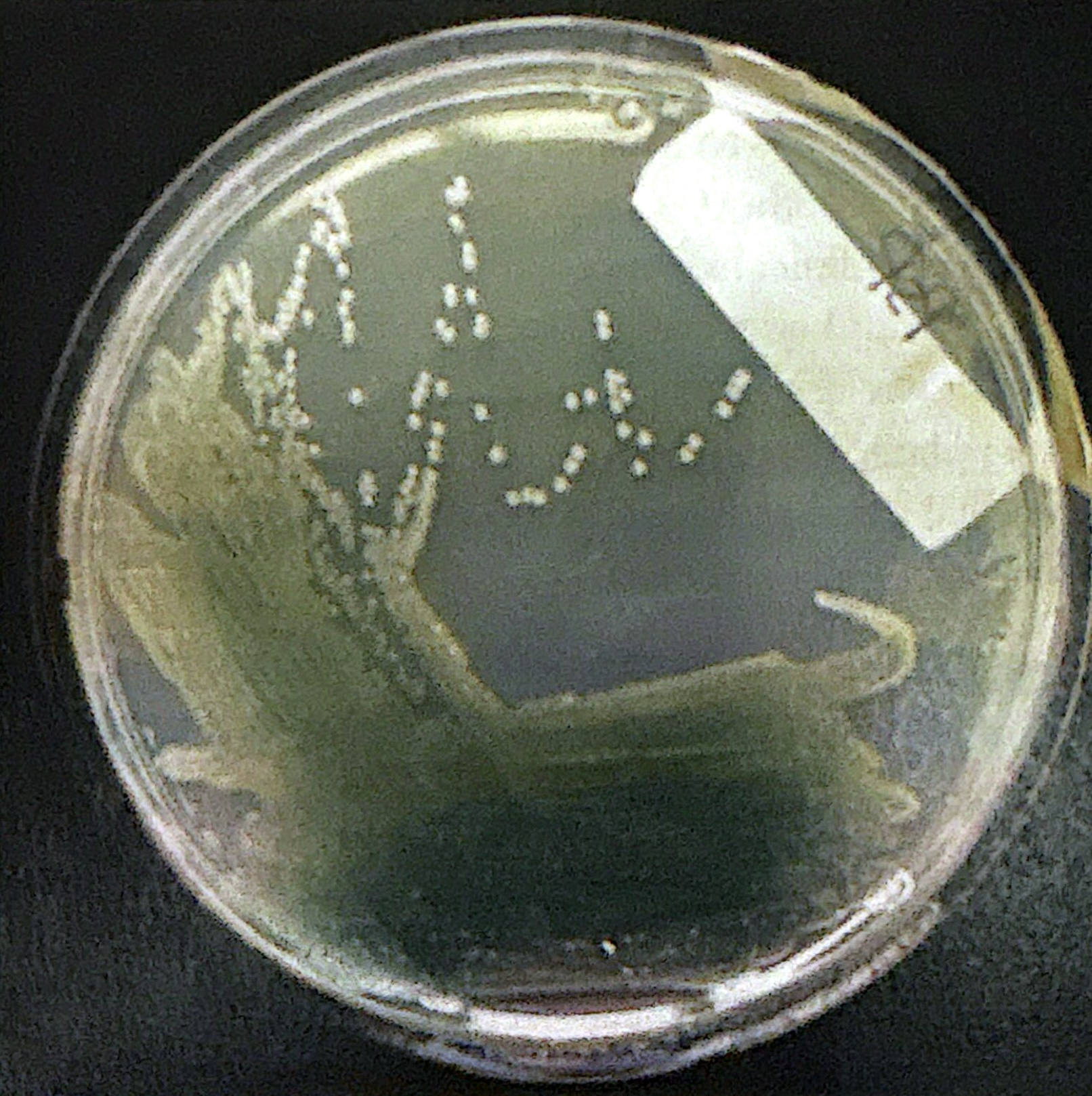 <p><span style="background-color: transparent;">Blue-green pigment. Red in pH < 5.</span></p>