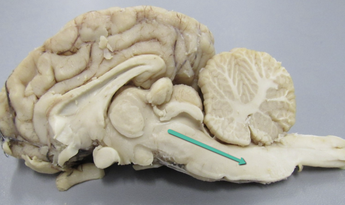 <p>Identify the structure indicated by the pointer.</p>