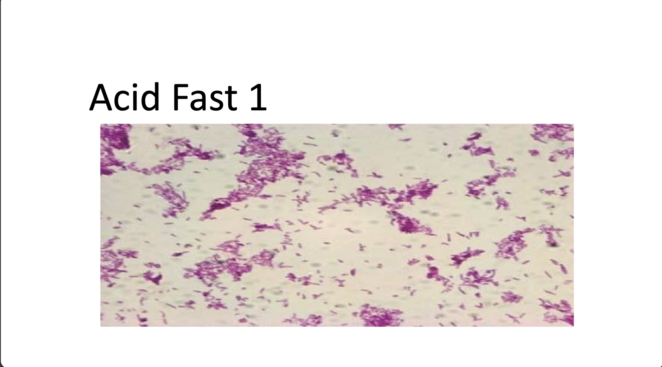 <p>positive/negative and morphology</p>
