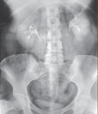 <p>what is this a projection of</p>