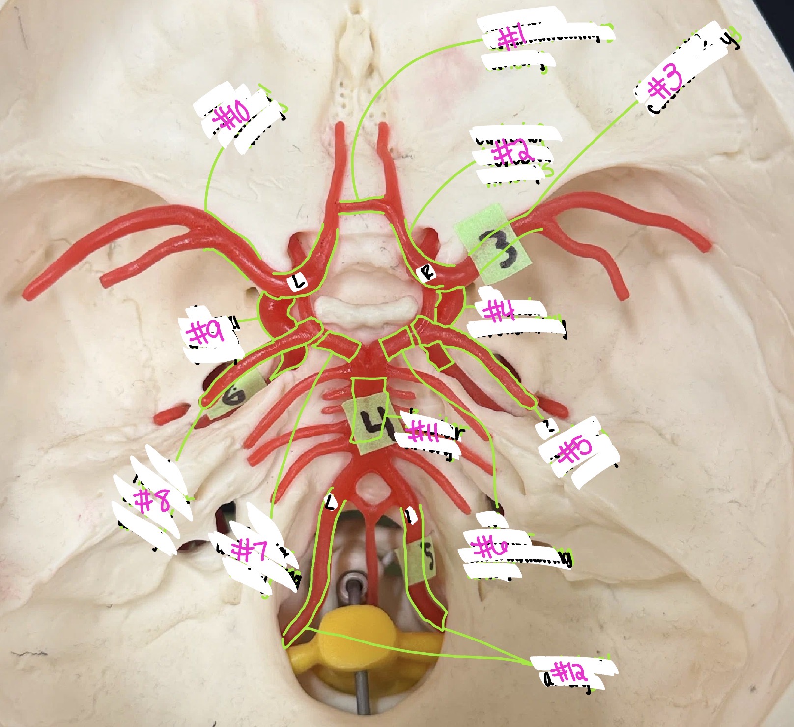 <p>what artery is labeled #6?</p>