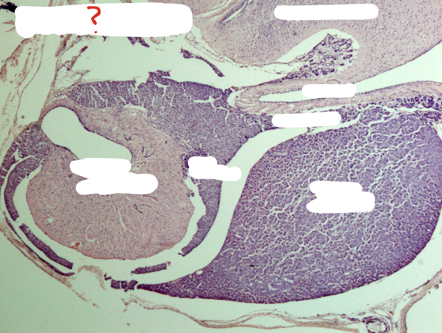 <p>Which gland is this?</p>