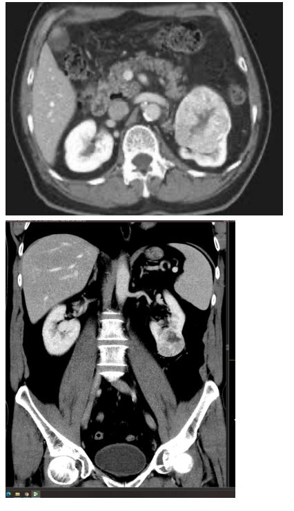 <ol><li><p>Imenuj tehniko slikanja </p></li><li><p>Naštej anatomske strukture, prikazane na sliki </p></li><li><p>Kateri je položaj slikanja? </p></li><li><p>Opiši patološke spremembe na sliki </p></li><li><p>Diagnoza?</p></li></ol><p></p>