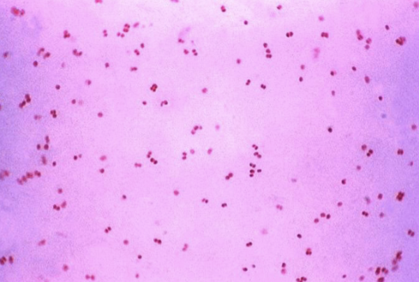 <p>which bacterial genus is a kidney/coffee bean shaped gram negative diplococci or coccobacilli?</p>
