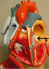 <p>Valve from the left atrium to the left ventricle</p>