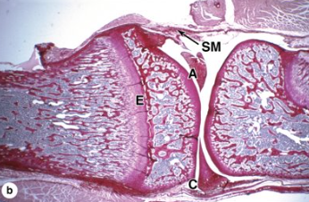 <p>What type of joint is this?</p>
