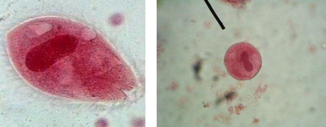 <p>PATHOGENIC PROTISTS:</p>