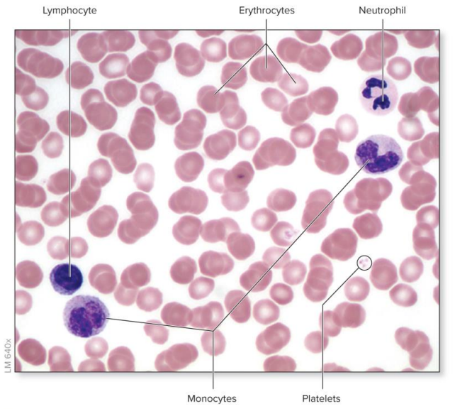 <p>Thin layer of blood placed on microscope slide and stained</p><p>Formed elements differ in appearance:</p><ul><li><p><strong>Erythrocytes </strong>are most numerous: pink, anucleate, biconcave discs</p></li><li><p><strong>Leukocytes</strong>: larger than erythrocytes, varied in form, noticeable nucleus</p></li><li><p><strong>Platelets</strong>: small fragments of cells</p></li></ul><p></p>