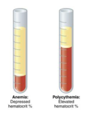 <p>Hematocrit</p><p>- anemia: low hct</p><p>- polycythemia: elevated hct</p>
