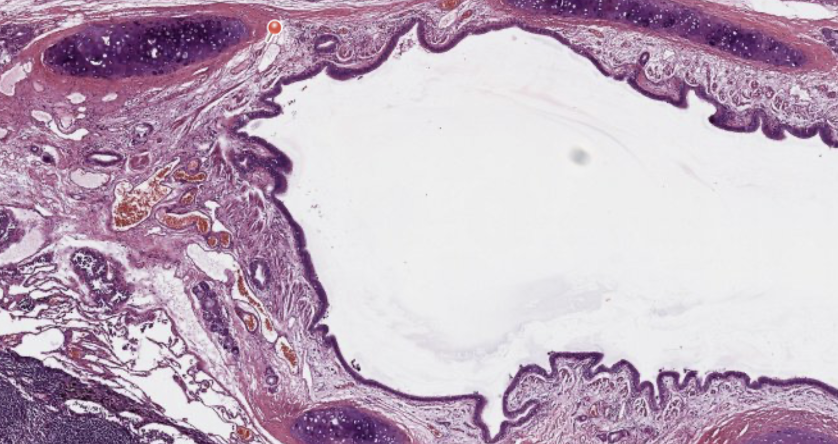 <p>Lung</p>
