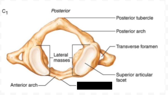 <p>What part of the atlas (C1) is this?</p>