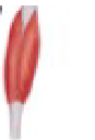 <p>Rectus femoris - what pattern</p>