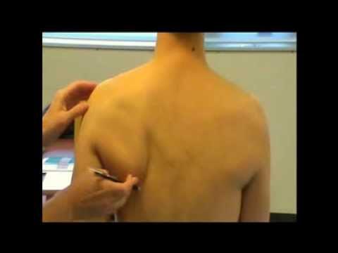 <p><strong>How to Palpate:</strong></p><ul><li><p>Move down medial border to tip of scapula.</p></li></ul><p></p><p>Confirm: Ask patient to actively abduct the arm—angle moves laterally.</p>