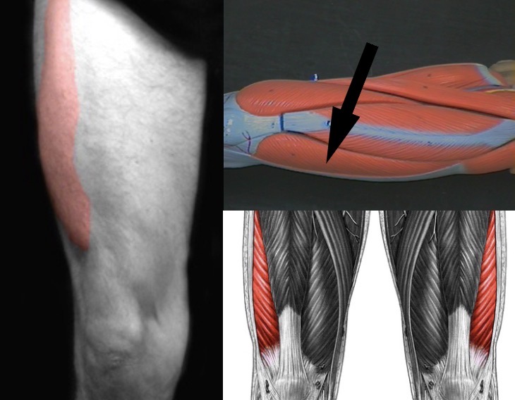 <p>What muscle is this?</p>