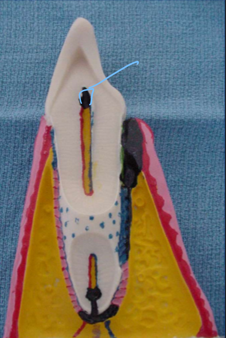 <p>This internal structure is the __ __, and contains the __ and __</p>