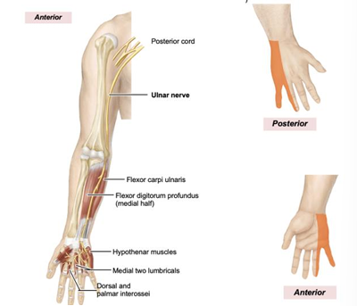 <p>sensory: medial hand, motor: anterior forearm - just medial half of flexor digitorum profundus and flexor carpi ulnaris, hand: hypothenar muscles, lumbricals to fingers 4 and 5, interossei. FOR DONOR: most medial on the M</p>