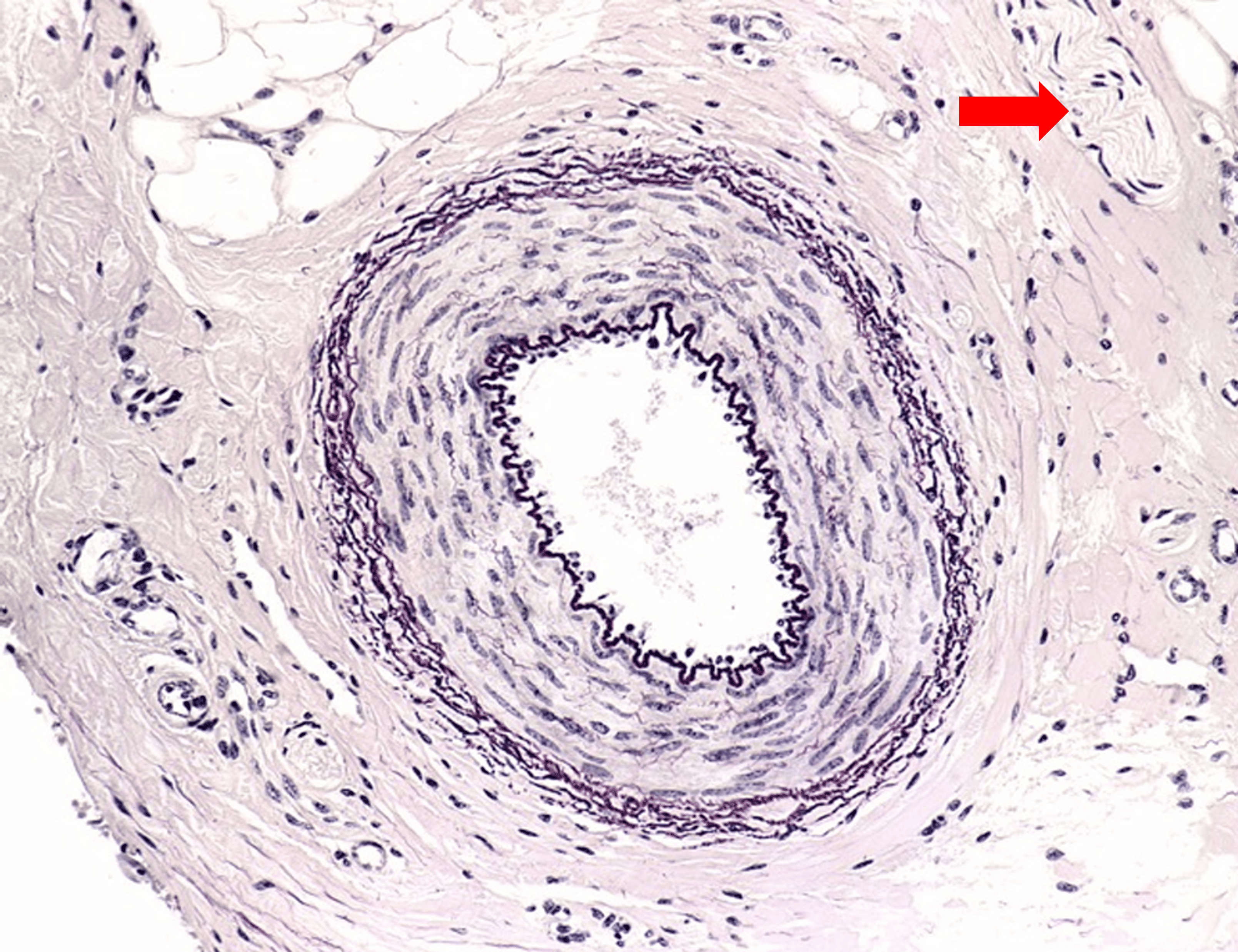 term image