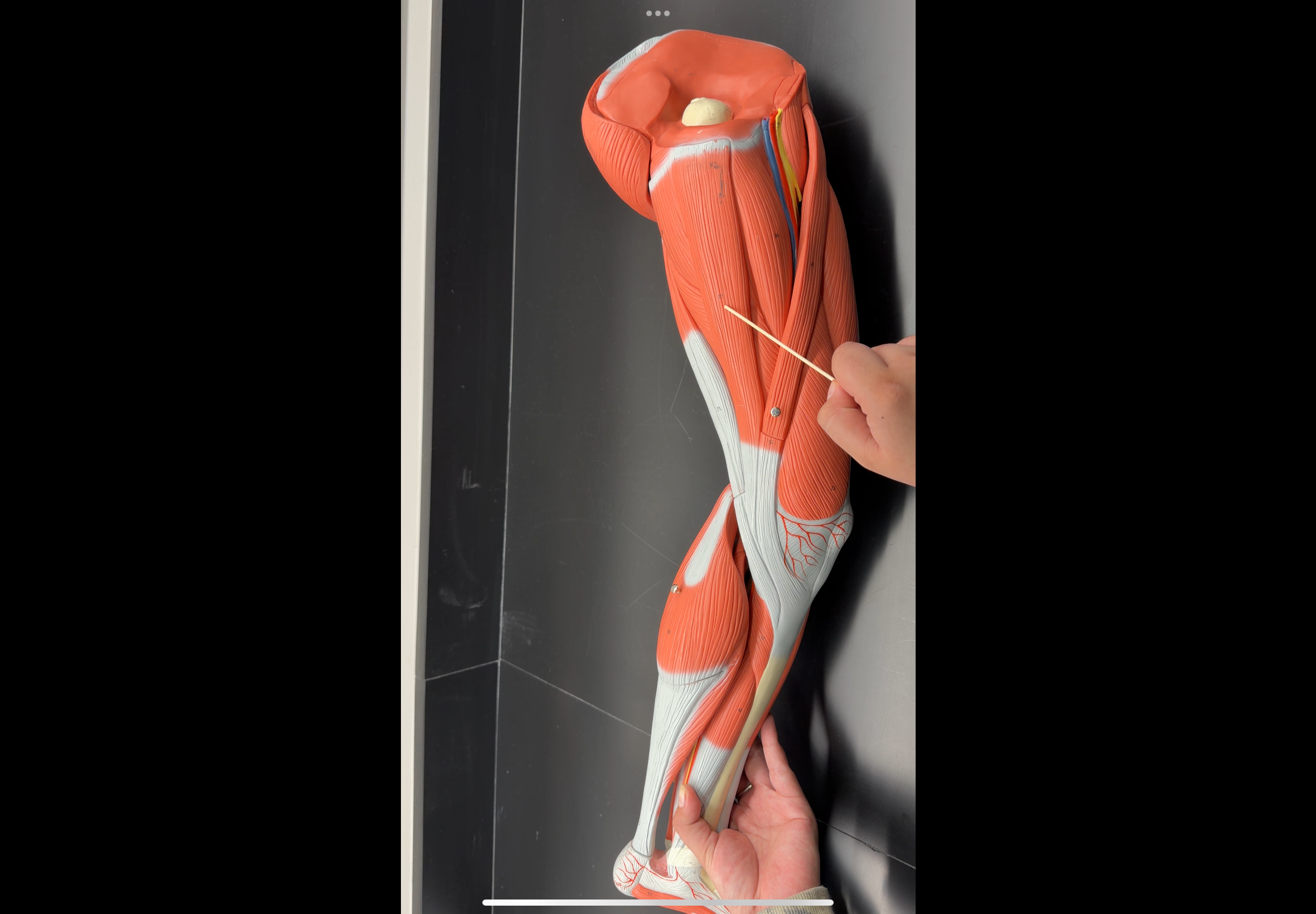 <p>name the muscle and its function</p>