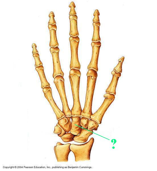 <p>Identify the indicated bone</p>