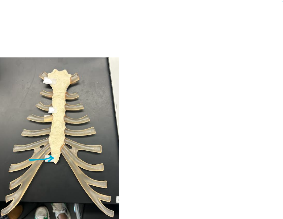 <p>ID sternum/ribs region </p>