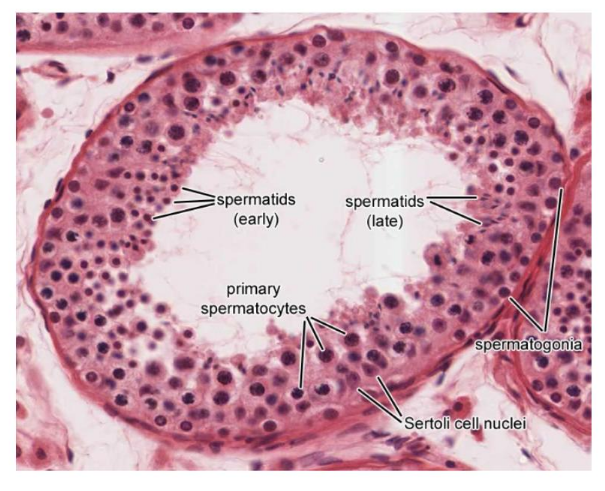 <p>label the TS seminiferous tubule in a testis</p>