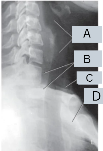 <p>label image</p>
