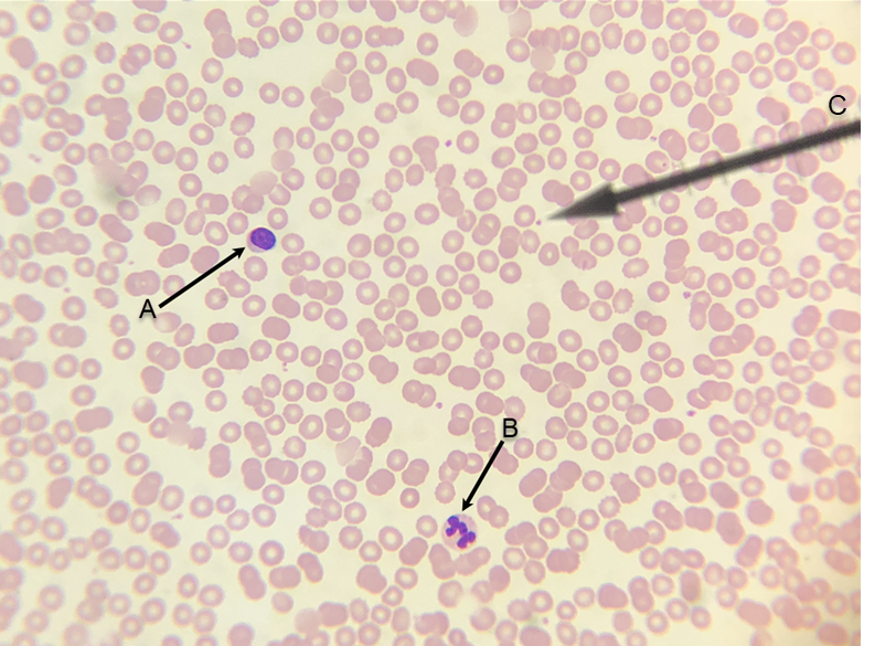 <p>In the image above, identify formed elements A, B, and C.</p>