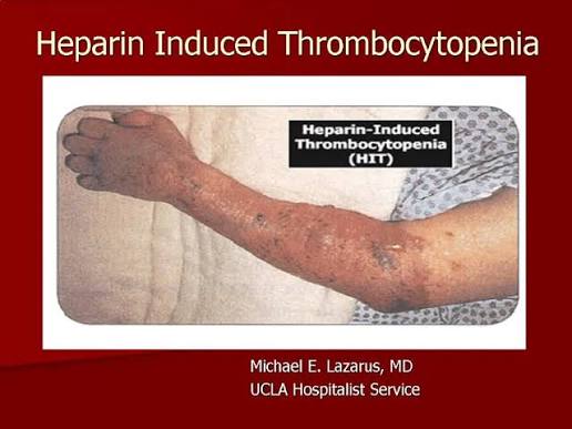 <p><strong><span>Heparin</span></strong><span> serious adverse effect?</span></p>