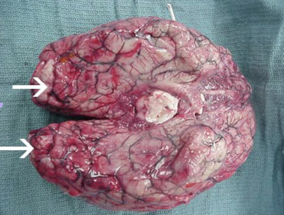<p>What disease is this? What parasite causes it?</p>