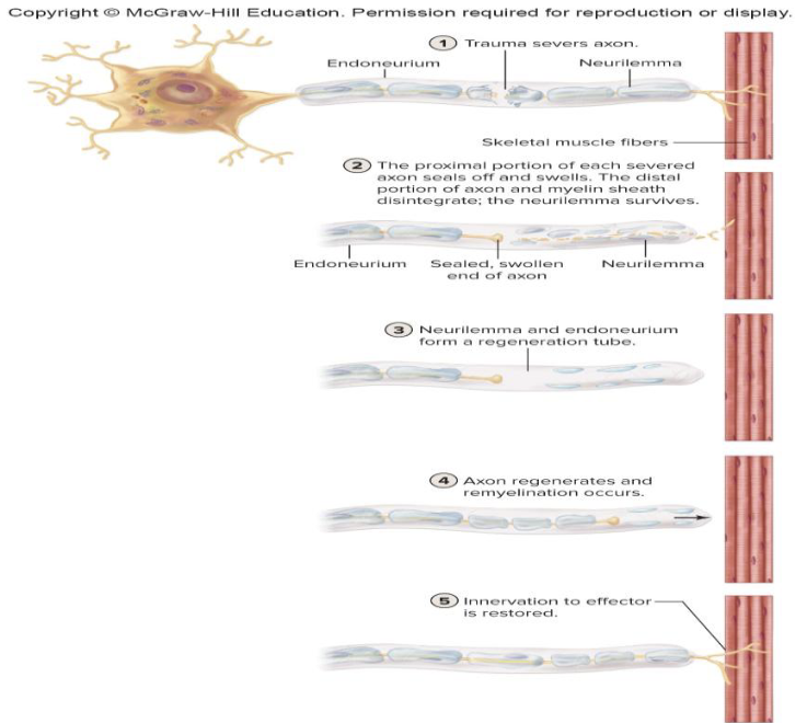 <p>Nerve Regeneration</p><ul><li><p>Can nerves regenerate in the PNS?</p></li><li><p>What factors affect PNS regeneration?</p></li><li><p>How do Schwann cells help regeneration?</p></li></ul><p></p>