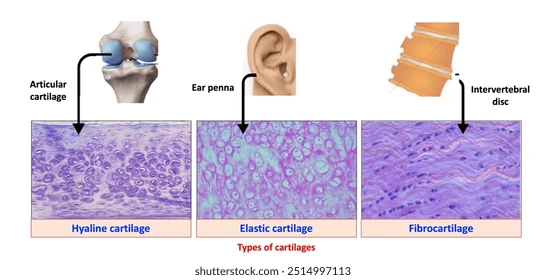 <p><strong>1. Hyaline cartilage</strong></p><ul><li><p><span>Most common</span></p></li><li><p><span>Found in: nose, trachea, ribs (costal), articular surfaces, fetal skeleton</span></p></li></ul><p><strong>2. Elastic cartilage</strong></p><ul><li><p><span>Flexible, contains elastic fibers</span></p></li><li><p><span>Found in: ear (pinna), epiglottis, auditory tube</span></p></li></ul><p><strong>3. Fibrocartilage</strong></p><ul><li><p><span>Tough, dense, resists compression</span></p></li><li><p><span>Found in: intervertebral discs, pubic symphysis, menisci</span></p></li></ul><p></p>