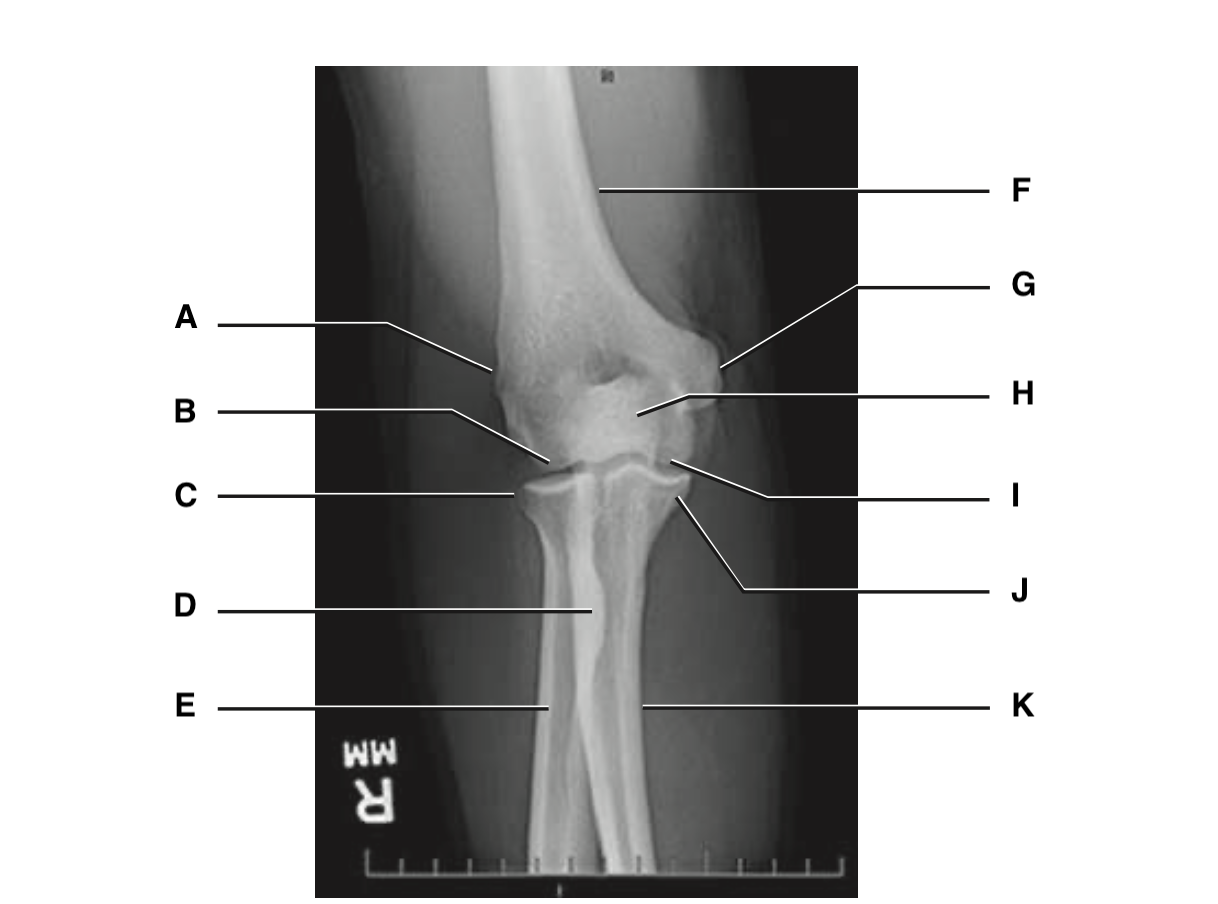 <p>H</p>